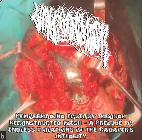 Larvae Cannibalism : Hemorrhaging Ecstasy Through Reconstructed Flesh - A Prelude to Endless Violations of the Cadaver's 